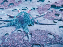 Cancer Cells Modify Cell Competition to Boost Their Own Capability to Invade