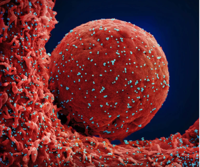Extended COVID lung injury and immune system reaction