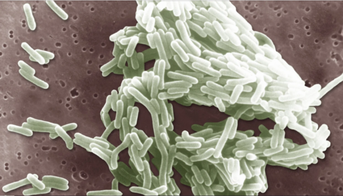Listeria outbreak that killed two people was probably caused by sliced deli meats.
