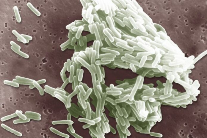 Scan electron micrography of Listeria Monocytogene.BSIP / Universal Images Group via Getty Images file